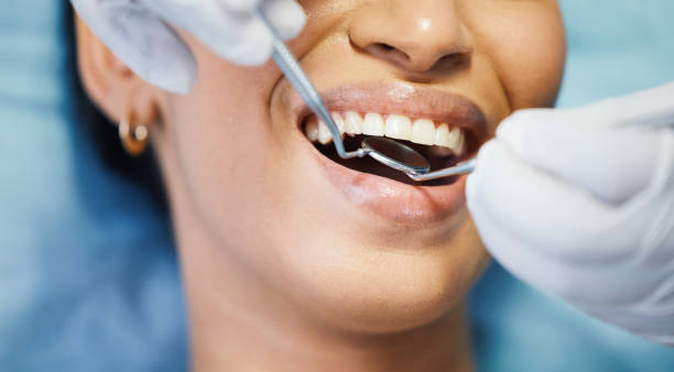 Best Emergency Treatment for Oral Infections in Mcchord Af, WA