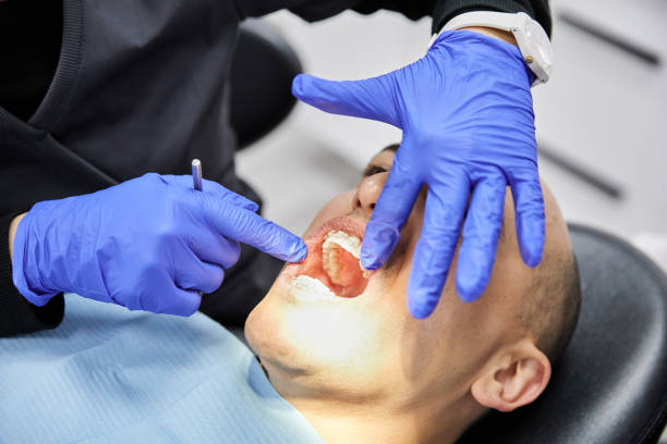 Best Emergency Dental Care for Sports Injuries in Mcchord Af, WA
